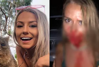 American woman attacked on holiday warns others to take out full travel insurance